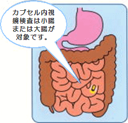 カプセル内視鏡検査は小腸が対象です。