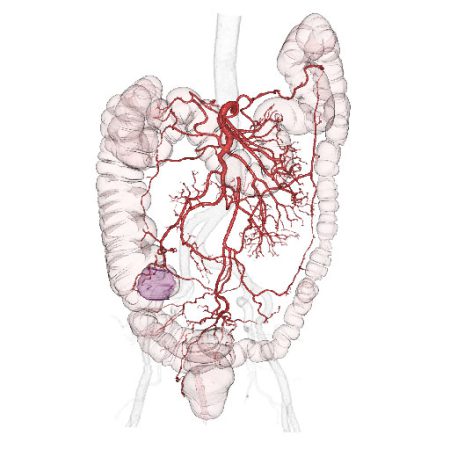 大腸全体と腹部の動脈との関係